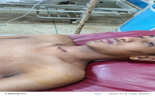 ফেঞ্চুগঞ্জে সালিশ বৈঠকে হামলা, বৈঠকে শ্বাসনালী কেটে যুবককে হত্যার চেষ্টা